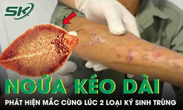 Người đàn ông tá hoả phát hiện mắc cùng lúc hai loại ký sinh trùng từ dấu hiệu ngứa kéo dài