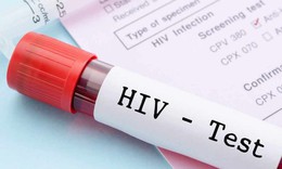 5 dấu hiệu cảnh báo nhiễm HIV nhiều người nhầm với bệnh thông thường