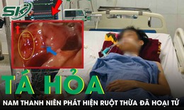 Tưởng bị rối loạn tiêu hóa, nam thanh niên 23 tuổi tá hỏa phát hiện ruột thừa đã hoại tử