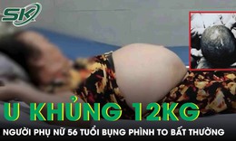 Bụng to bất thường, người phụ nữ 'khóc ngất' khi phát hiện khối u khổng lồ nặng tới 12kg 