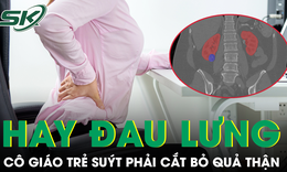 Đau lưng kéo dài nhưng chủ quan, cô giáo trẻ suýt phải cắt bỏ quả thận