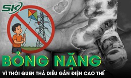 Người đàn ông 57 tuổi bỏng nặng vì thói quen thả diều gần điện cao thế