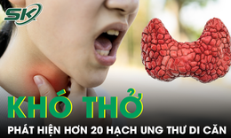 Khó thở mất tiếng, người phụ nữ phát hiện hơn 20 hạch ung thư di căn
