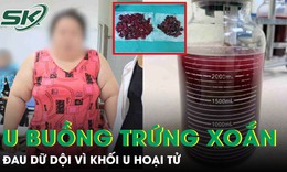 Cô gái nặng 120kg đau bụng dữ dội vì hoại tử khối u buồng trứng xoắn 20cm