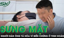 Tá hỏa vì tinh hoàn gặp biến chứng do chủ quan với dấu hiệu sưng mặt