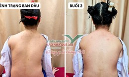 Tìm hiểu nguyên lý 'Khai thông cột sống' của Lão Nhà Quê