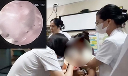 Thường xuyên chơi với thú cưng, bé gái 2 tuổi bị bọ chét ký sinh trong tai 