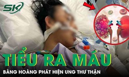 Người đàn ông 51 tuổi bàng hoàng phát hiện ung thư thận từ dấu hiệu tiểu ra máu