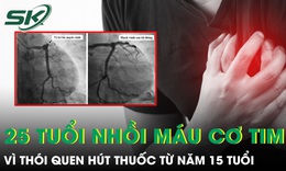 Hút thuốc từ năm 15 tuổi, nam thanh niên 25 tuổi bất ngờ nhồi máu cơ tim 