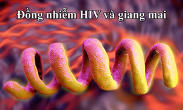 Đồng nhiễm HIV và giang mai: Tầm soát định kỳ để ngăn chặn biến chứng tổn thương thần kinh