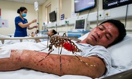 Phân biệt sốt xuất huyết và cúm mùa