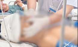 Bộ Y tế hỏa tốc chỉ đạo tập trung cứu chữa nạn nhân vụ tai nạn trên cao tốc Pháp Vân - Cầu Giẽ