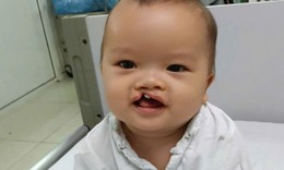 Bé trai 8 tháng tuổi bị bỏ rơi trước cổng chùa cần trợ giúp để phẫu thuật dị tật