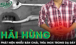 Đau bụng âm ỉ, người đàn ông khiến bác sĩ sốc khi trong dạ dày có nhiều bàn chải và thìa inox