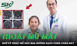 Mổ não qua đường rạch cung chân mày cứu người bệnh thoát nguy cơ mù mắt