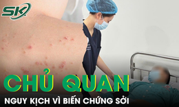 Người đàn ông mắc biến chứng nặng do chủ quan với bệnh sởi