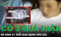 Nữ sinh 21 tuổi đau bụng kéo dài, bác sĩ phát hiện cơ thể có tới 3 quả thận