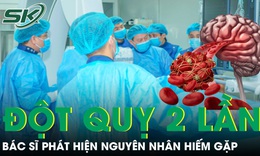 Người phụ nữ hai lần đột quỵ trong một ngày bác sĩ phát hiện nguyên nhân hiếm gặp 