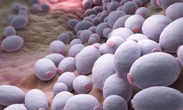 Đau rát vùng miệng, lưỡi kéo dài cảnh giác với nấm miệng họng do Candida