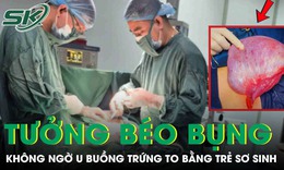 Tưởng bụng to do tuổi tác, người phụ nữ 59 tuổi mang khối u buồng trứng to bằng trẻ sơ sinh