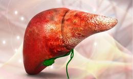 Ung thư gan có di truyền và những người thuộc nhóm nguy cơ cao