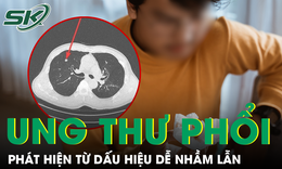 Nam kỹ sư phát hiện mắc ung thư phổi di căn ở tuổi 34 từ dấu hiệu nhiều người dễ chủ quan