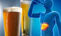 Ngoài hạn chế rượu bia, những thói quen nào giúp phòng bệnh gan hiệu quả? 