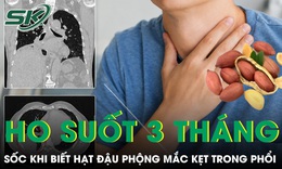 Ho suốt 3 tháng, người đàn ông sốc khi bác sĩ gắp ra hạt đậu phộng mắc kẹt trong phổi