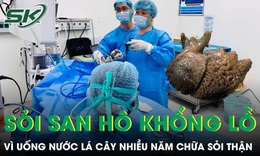 Uống nước lá cây nhiều năm người đàn ông nuôi khối sỏi san hô khổng lồ trong thận 