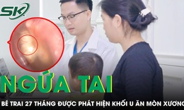 Bé trai 27 tháng tuổi liên tục gãi tai bác sĩ phát hiện khối u ăn mòn xương tai 