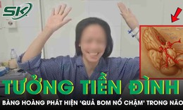 Đau đầu tưởng tiền đình, người phụ nữ bàng hoàng phát hiện “quả bom nổ chậm” trong não