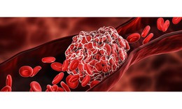 5 thực phẩm làm sạch mạch máu bạn nên ăn hằng tuần
