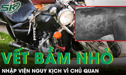 Sau 5 ngày tự theo dõi vết bầm, người phụ nữ nhập viện trong tình trạng sốc nhiễm khuẩn