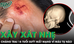 Chỉ xây xát nhẹ sau tai nạn, chàng trai 18 tuổi suýt mất mạng vì tụ máu não
