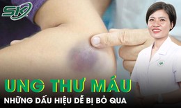 Những dấu hiệu ung thư máu dễ bị bỏ qua