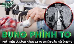 Bụng phình to không đại tiện được, bàng hoàng phát hiện lá lách nặng 3,5kg
