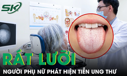 Rát lưỡi kéo dài, bất ngờ phát hiện tiền ung thư