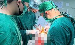 Đau đầu kéo dài, cụ bà 73 tuổi phát hiện khối u não lớn