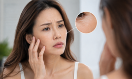 6 dấu hiệu làn da đang già đi nhanh hơn tuổi thật