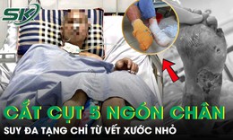 Người đàn ông suy đa tạng, phải cắt cụt 5 ngón chân chỉ từ vết xước nhỏ