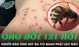 Bị 121 nốt ong đốt, người đàn ông suy đa cơ quan phải lọc máu