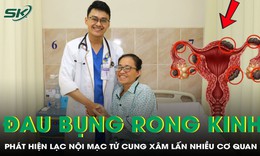 Đau bụng, rong kinh suốt 18 tháng, người phụ nữ phát hiện lạc nội mạc tử cung xâm lấn nhiều cơ quan