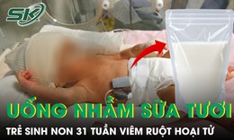 Nhầm sữa mẹ với sữa tươi, trẻ sinh non 31 tuần mắc viêm ruột hoại tử