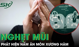 Bị nghẹt mũi, người đàn ông 64 tuổi phát hiện nấm ăn mòn xương hàm