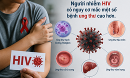 Người nhiễm HIV có cần tầm soát ung thư sớm hơn người bình thường?
