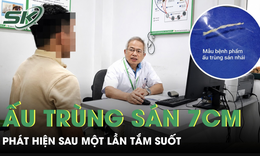 Tắm suối một lần, người đàn ông 40 tuổi phát hiện ấu trùng sán dài 7cm