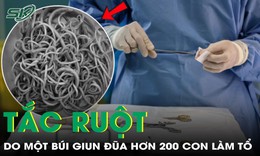 Bé gái 9 tuổi bị tắc ruột do một búi giun đũa hơn 200 con làm tổ