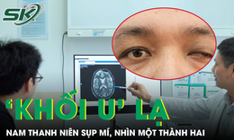 Nam thanh niên sụp mí, nhìn một thành hai vì 'khối u' lạ