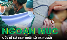 Bé sơ sinh ruột lộ ngoài cơ thể, được cứu sống sau ca mổ khẩn