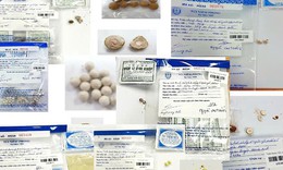 Uống thuốc ‘gia truyền’ mua trên mạng, người đàn ông bị Gút cấp nặng